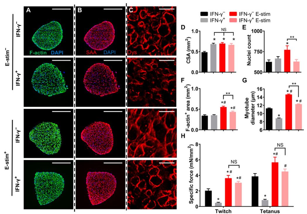 E-刺激可防止IFN-γ引起的肌管長(zhǎng)度，肌小節(jié)豐度和收縮蛋白表達(dá)減少
