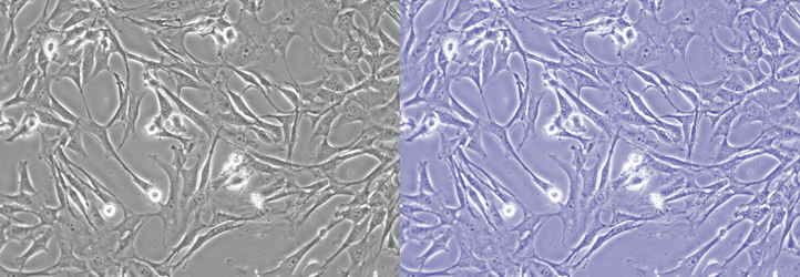 Leica DM IL LED倒置熒光顯微鏡細(xì)胞圖像色溫調(diào)整效果對比.jpg